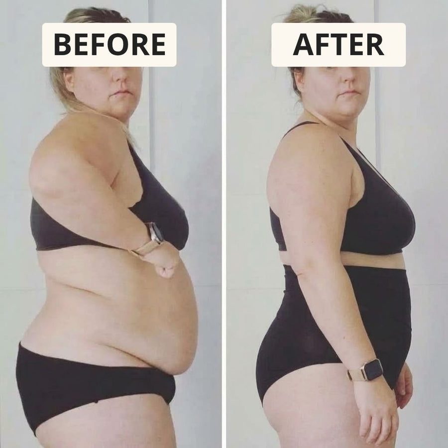 Before and after: side profile, belly flattened
